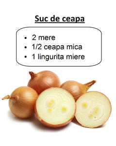 suc-de-ceapa